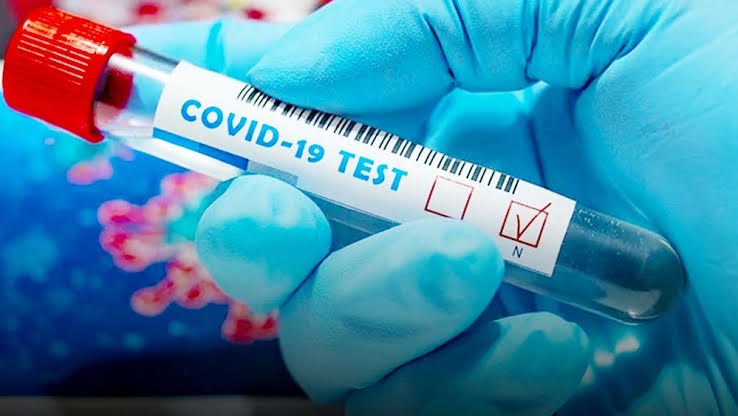 Hasil Tes Masif, 601 Orang Kedapatan Positif Covid-19 Di Ibukota