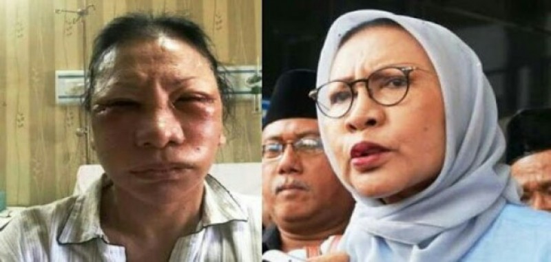 Dikeroyok Hingga Babak Belur, Ratna Sarumpaet Trauma Berat